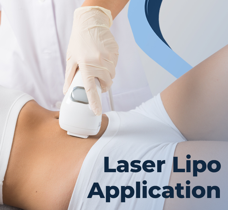 Laser Lipo Application